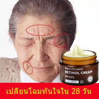 ครีมบำรุงหน้า ครีมริ้วรอย ครีมลบเลือนริ้วรอย เรตินอล ครีมต่อต้านริ้วรอย retinol cream ครีมทาหน้าขาว เรตินอลครีมแท้ ครีมบำรุงผิวหน้า ลดริ้วรอยหน้า