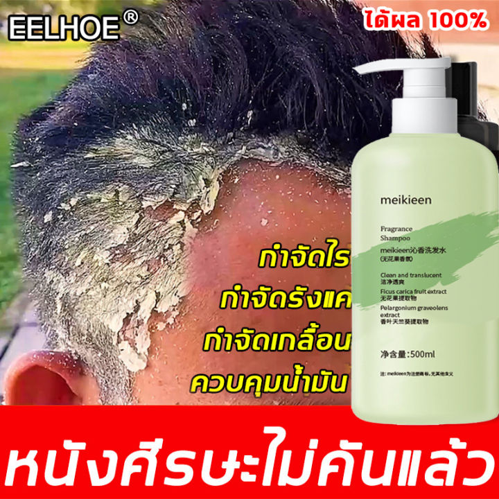 meikieen-แชมพูขจัดรังแค-500ml-ควบคุมความมันและกำจัดรังแค-รากผมแข็งแรง-ฟองละเอียด-กำจัดผมชี้ฟู-แก้ปัญหาตั้งแต่ต้นตอของหนังศีรษะ-ยาสระผมรังแค-ยาสระผมเชื้อรา-ยาสระผมแก้คัน-เชื้อราบนศีรษะ-แชมพูแก้คันหัวแช