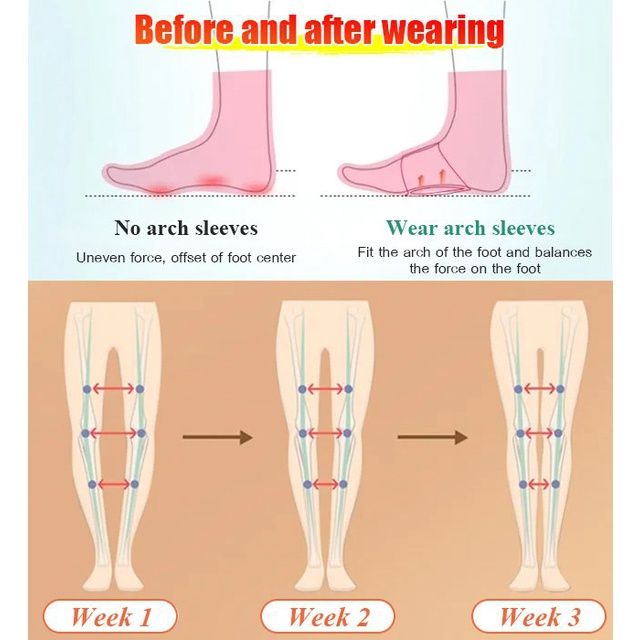 hailicare-1-คู่-arch-support-pads-ผ้าพันแผลยืดหยุ่นกีฬา-foot-pad-แก้ไขเท้าแบนบรรเทาปวดภายในและภายนอกแปดตัวอักษร-orthopedic-foot-care-unisex