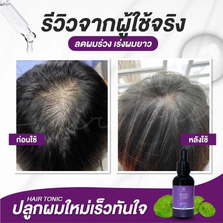 ส่งฟรี-chaba-ชบาโทนิค-ปลูกผม-ป้องกันผมร่วง