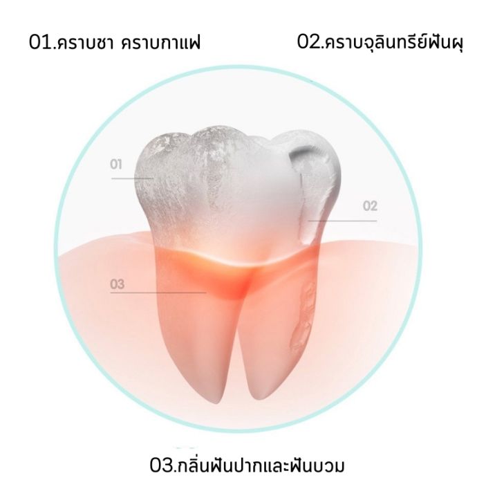 ที่ขูดหินปูน-เครื่องขูดหินปูนไฟฟ้า-เครื่องมือขูดหินปูน-เครื่องทำความสะอาดฟัน-พร้อมไฟ-2led-ปรับความเร็วได้-3-ระดับ-เสียงเบา-ivvy