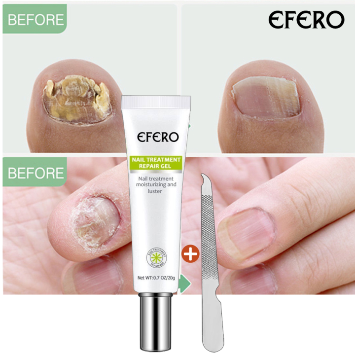 EFERO Nail Fungus Serum Antifungal Nail Serum Nail Fungus Removal Toe Moisturizing and Shining