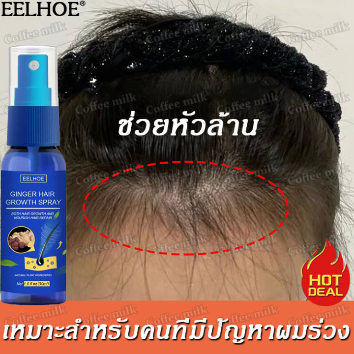 บอกลาหัวล้าน-eelhoe-สเปรย์ปลูกผม-เร่งผมขึ้นใหม่-เร่งผมยาวไว-ป้องกันผมร่วง-ป้องกันผมร่วงอย่างมืออาชีพ-แก้ปัญหาผมร่วง-ลดผมร่วง-น้ำยาใส่ผม-ยาปลูกผม-น้ำยาปลูกผม-น้ำยาเร่งผมยาว-เซรั่มปลูกผม-ปลูกผมเร่งด่วน-