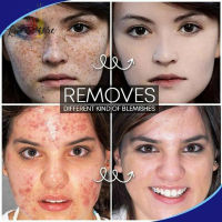 [La vis] Pro.W Blemish Cream Freckles Acne Pimple Scar Dark Spots Removal Skin Whitening Brightening