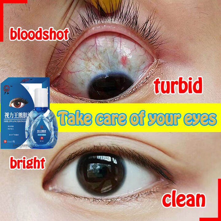 Blueberries Eye drops relieve fatigue miracle eye care drops eye drops