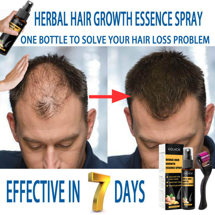 hair grower for men original spray minoxidil hairtech original hair ...