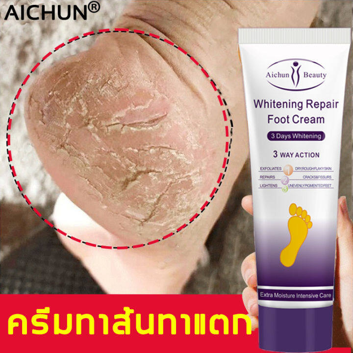 ครีมบำรุงเท้า-100ml-ครีมทาเท้าแตก-ป้องกันรอยแตกเท้า-ซ่อมแซมส้นเท้าแห้งแตก-แห้ง-หยาบ-หนังแข็ง-ครีมทาส้นทาแตก-ครีมทาส้นเท้า-ทาส้นเท้าแตก-ส้นท้าวแตก