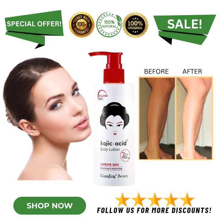 100 Original Kojic Acid Whitening Body Lotion 230g Refreshing and
