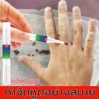 ?[จัดส่งทันที]?คู่มือภาษาไทยYIMIWEILAI （ยาทาหูด/ช่วยให้หูดหรือตาปลาหลุดออก/หูดตาปลา/ลอกหูดตาปลา/แคลลัสและรากหนาม/หูดและติ่ง）