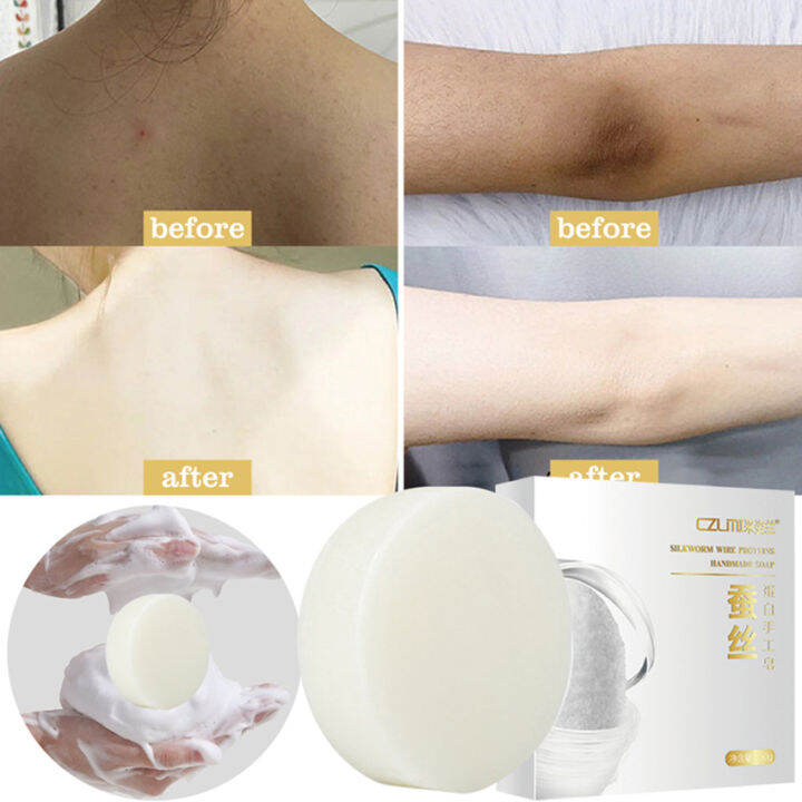 Body Whitening Soap Underarm Knee Bleaching Soap Chicken Skin Removal