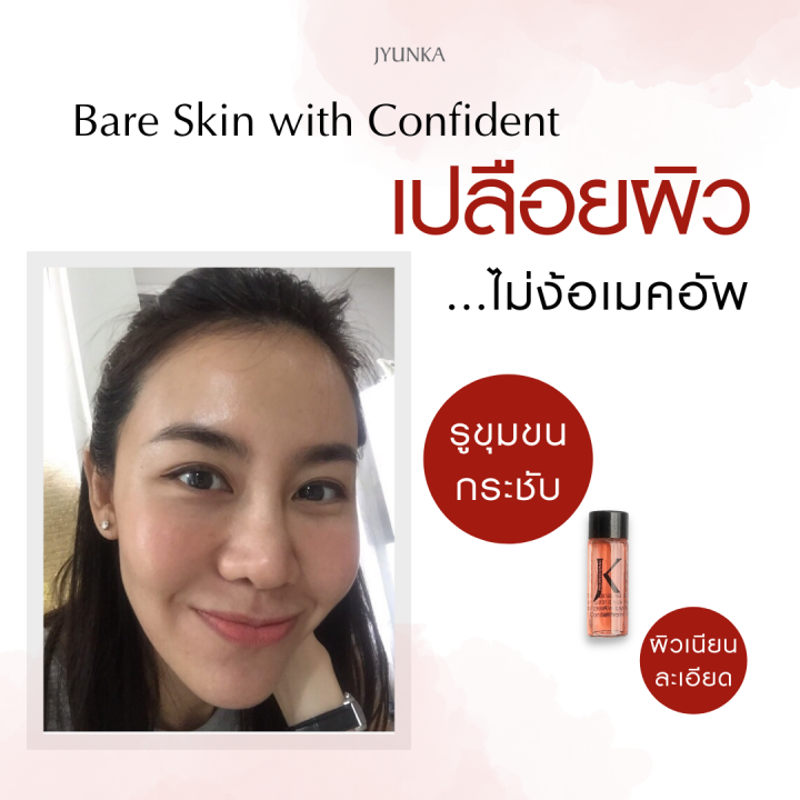 jyunka-kit-a3-concentrate-amp-a3-cream-เซ็ตผลิตภัณฑ์ดูแลผิว-ลดสิว-ผดผื่น-เพิ่มความชุ่มชื้น