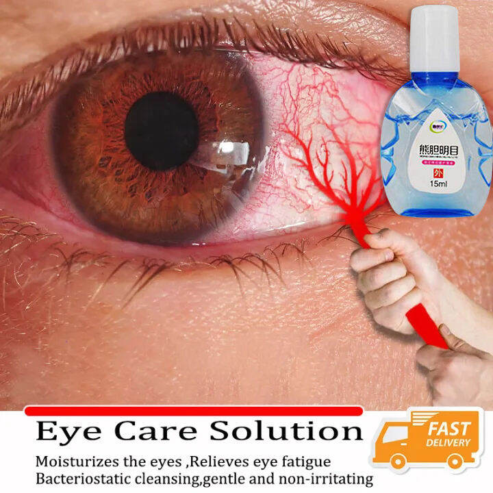 【Restore you vision】Eye Drops Dry Eye AntiFatigue Eye Congestion Blurred Eyes Redness Eyes