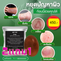 (2แถมฟรี1)MR.TAR Soap สบู่น้ำมันดิน (100 g.) สะเก็ดเงิน เซบเดิร์ม ผิวหนังอักเสบ ผื่นคัน แถมถุงตีฟอง