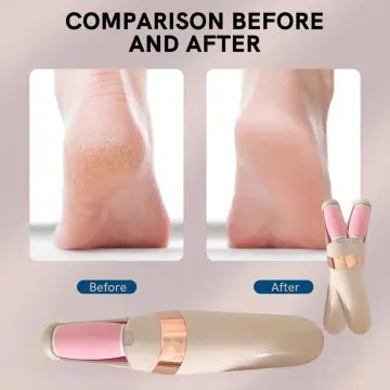 ENCHEN Foot Dead Skin Callus Remover Electric Pedicure Foot Care