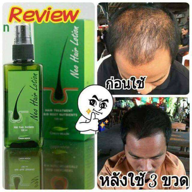 neo-hair-lotion-ของแท้-1-แถม-1-เซรั่มปลูกผม-นีโอแฮร์โลชั่น-neohair-นีโอแฮร์-ของแท้-1-ขวด-แถม-1-ขวด