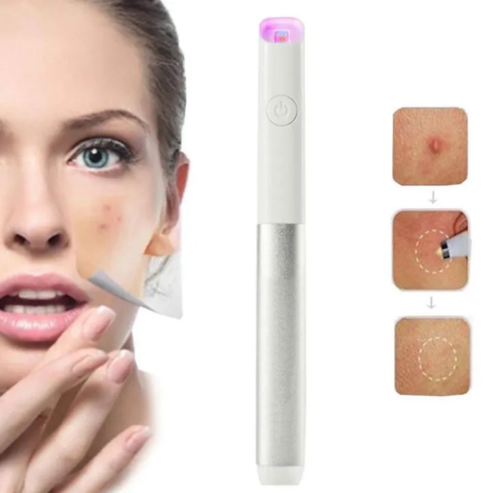 Blue Light Red Therapy Acne Spot Treatment Laser Pen Blackhead Blemish Remover Scar Wrinkle