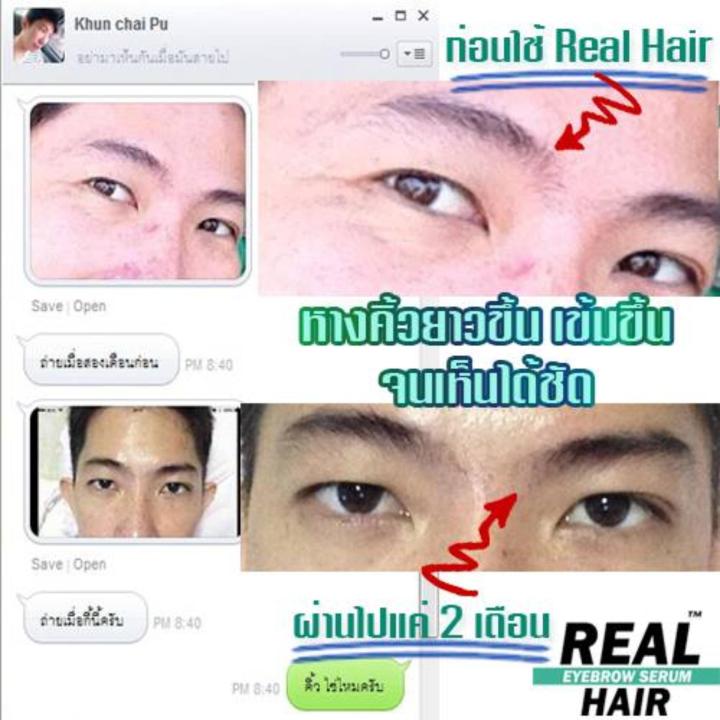 real-hair-eyebrow-serum-ขนาด12ml-เรียลแฮร์-อายโบร์ว-เซรั่ม-ปลูกขนคิ้ว-ขนตา-หนวด-เครา-จอนในขวดเดียว-2-กล่อง