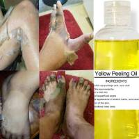 Citric Acid Thai Yellow Peeling Oil Bleaching Dark Skin Retinol With Peptide Spots Blackheads Blemishes Bad Skin Spot Treatment