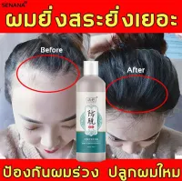 Amino Acid Oil Control worry free dandruff There are many effects against baldness and hair care (Pure Ginger Shampoo, Hair Growth Shampoo, Hair Regrowth Liquid, Hair Serum, Hair Regrowth Water, Real Hair Growth Potion, Thick Hair Growth Solution, Hairspr