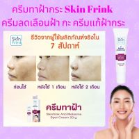 ครีมทาฝ้ากระ Skin Frink ครีมลดเลือนฝ้า กะ ครีมแก้ฝ้ากระ ครีมทาฝ้ากระจุดด่างดำ วุฒิศักดิ์ ลดเลือนจุดด่างดำ สีผิวไม่สม่ำเสมอ ส่งฟรี