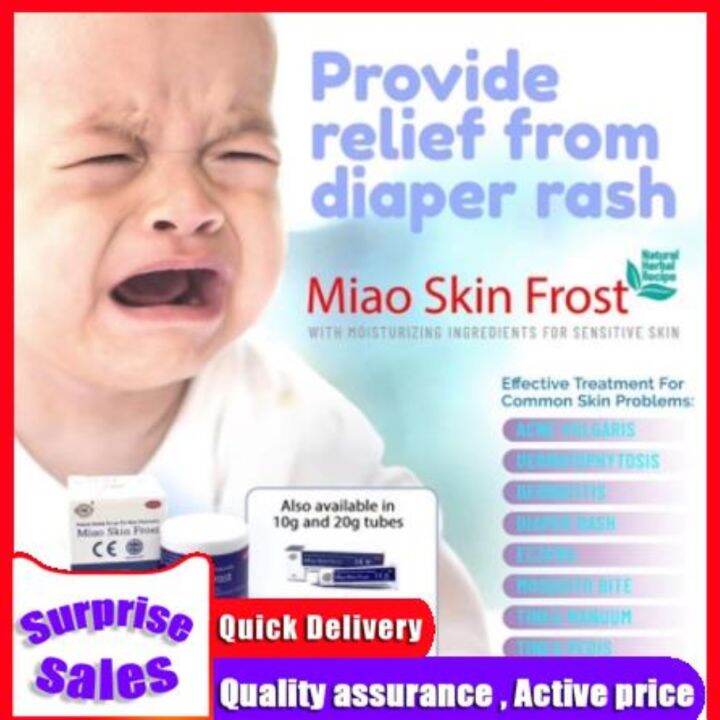 Baby Diaper Rash Cream (FOR ALL SKIN TYPES) Miao Skin Frost meetyou99