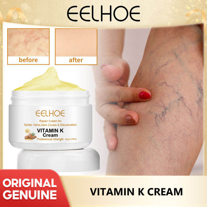 Eelhoe Vitamin K Cream Tendon Protrusion Swelling Earthworm Leg Massage