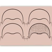 5PCS Scalp Tattoo Practice Skin Both Side Pre Draw Hairline Design Tattoo Silicone Pad for SMP Scalp Micropigmentation Technique USB Hubs