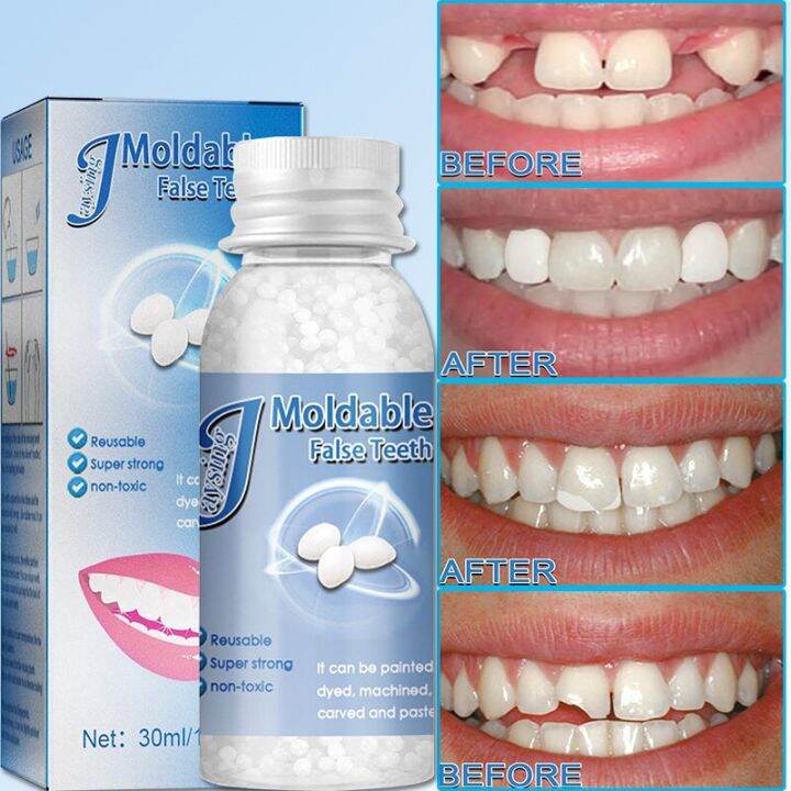 10ml Plastic Resin Temporary Tooth Repair Granules Denture Adhesive