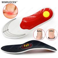 【CW】 Arch Support Orthopedic Insoles Feet O/X Plantar Fasciitis valgus insoles Shoes Men Shock Absorption Pain