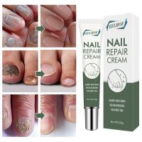 Fungus Nail Care Serum Hand For Foot Treatment Anti bacterial Infection Removal Paronychia Onychomycosis Gel Nail Repair Care