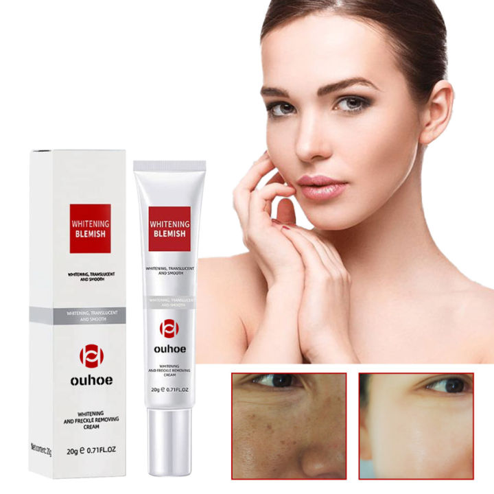 Effective Whitening Freckle Cream Remove Dark Spot Face Cream Removal Melanin Melasma Lighten