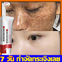 ครีมลดฝ้า EELHOE20g ครีมแก้ฝ้ากระ ครีมกำจัดสิว ครีมรักษาฝ้า ครีมทาฝ้ากระ    ครีมแต้มสิว เจลรักษาสิว ครีมไวท์เทนนิ่ง ครีมรักษาฝ้า เจลแต้มสิว กําจัดสิว ครีมทาฝ้ากระ ครีมลบฝ้า แก้ปัญหาสิวทุกชนิด  ครีมลดรอยสิว ลดรอยดำ（สีเขียว: ครีมสิว  สีแดง: ครีมทาฝ้ากระ）