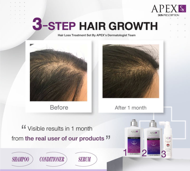 3-step-hair-growth-ชุด-สระ-นวดพ่น-ชุดลดผมร่วงกระตุ้นการงอกใหม่ของเส้นผม