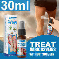 30Ml Varicose Vein Treatment สเปรย์บรรเทา Phlebitis Angiitis Remedy Pain Pain Spray สำหรับ Spider Veins อาการบวมน้ำเส้นประสาท Earthworm ขา