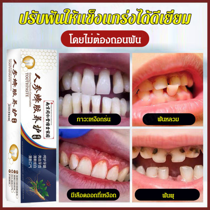meimingzi-1-2-ชิ้น-ยาสีฟันรักษาอาการฟันหลวมนำเข้าจากญี่ปุ่น