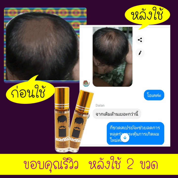 เซรั่มคิ้วดก-ยาปลูกหนวด-เซรั่มบำรุงขนตา-น้ำยาปลูกขนคิ้ว-น้ำยาปลูกผม-ที่ปลูกคิ้ว-ปลูกหนวด-คิ้วดำธรรมชาติ-ครีมปลูกคิ้ว-10-มล