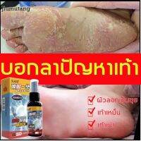 แค่ฉีดก็ดีขึ้น JIUMUTANG แก้เท้าเหม็น50ml ป้องกันกลิ่นเท้า คันเท้า ผิวลอก แผลพุพอง เท้าเน่า ให้ความชุ่มชื้น ซ่อมแซม ผ่อนคลาย (โรคผิวหนัง กลิ่นเท้า เท้าคันแครีมระงับกลิ่นเท้า สะเก็ดเงิน ดับกลิ่นเท้า ณ์ดับกลิ่นเท้า ยาดับกลิ่นเท้า รีมติดเชื้อรา ครีมบำรุงเท้า