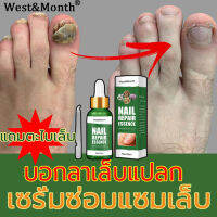 West&amp;Month 30ml เซรั่มบำรุงเล็บ เล็บเท้าเล็บมือ บำรุงเล็บ (ซ่อมแซมเล็บ เล็บขบ ซ่อมเล็บ เชื้อราเล็บ) ดูแลเล็บ ปรับปรุงเ ล็บให้แข็งแรงและมีสุขภาพดีใน ภายใน7วัน เซรั่มซ่อมแซมเล็บ ครีมบำรุงเล็บ ได้ผลเร็ว คุณภาพสูง สำหรับปัญหาเล็บต่างๆNail Repair Essence Serum