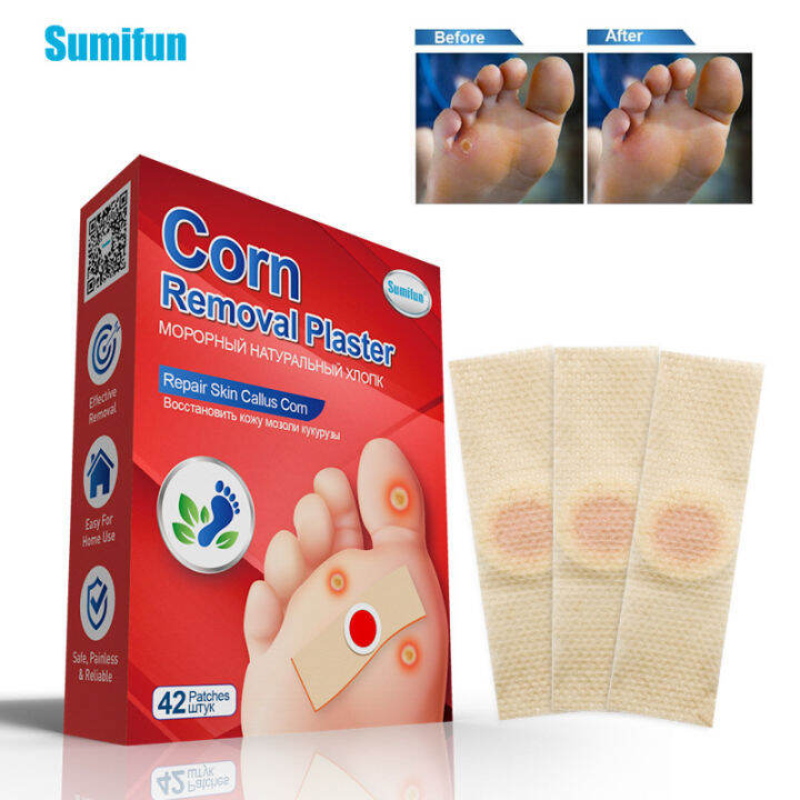 British-russian Corn Paste Corn Paste Foot Patch Painlessly Removes 