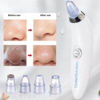 เครื่องดูดสิวเสี้ยน มีหลายหัว ดูดออกถึงราก ถึงยวง DermaSuction เครื่องดูดสิวเสี้ยนไฟฟ้า เครื่องดูดสิว