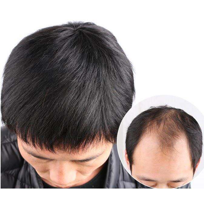 middle-aged-man-wig-dad-wig-natural-short-hair-black-100-real-hair-man-wig-handmade-bald-patch