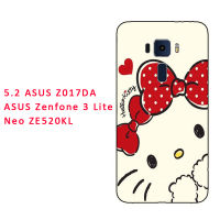 เคสนิ่มสำหรับ ASUS Z017DA/Zenfone 3 Lite/ Neo ZE520KL/Z01MD (ZD552KL)/ X00LD/ZD553KL/Z012D/ZenFone3 (ZE552KL)/Z010D/ Z01HDA/ZE553KL ซิลิโคน