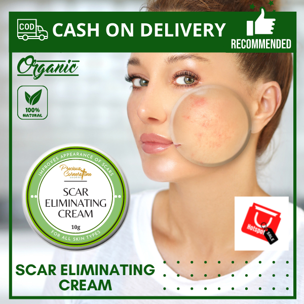 HOTSPOT Scar Eliminating Cream All Natural and Organic Whitening Cream