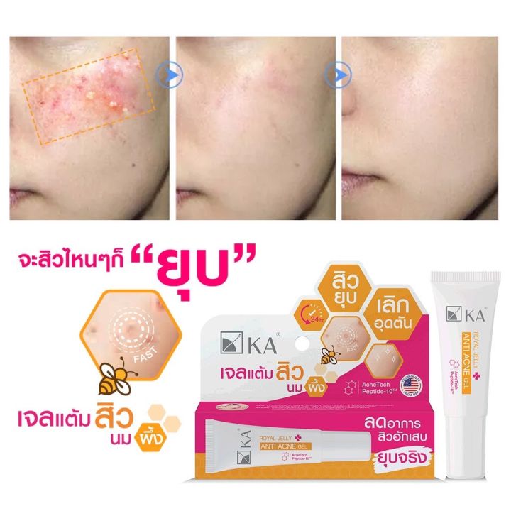 สินค้าใหม่-เจลแต้มสิวนมผึ้ง-ka-royal-jelly-anti-ance-gel-7-กรัม