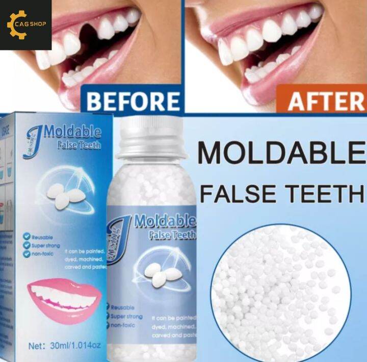 CAG Shop 30ML False Teeth Repair Kit Teeth and Gaps Teeth Denture Teeth