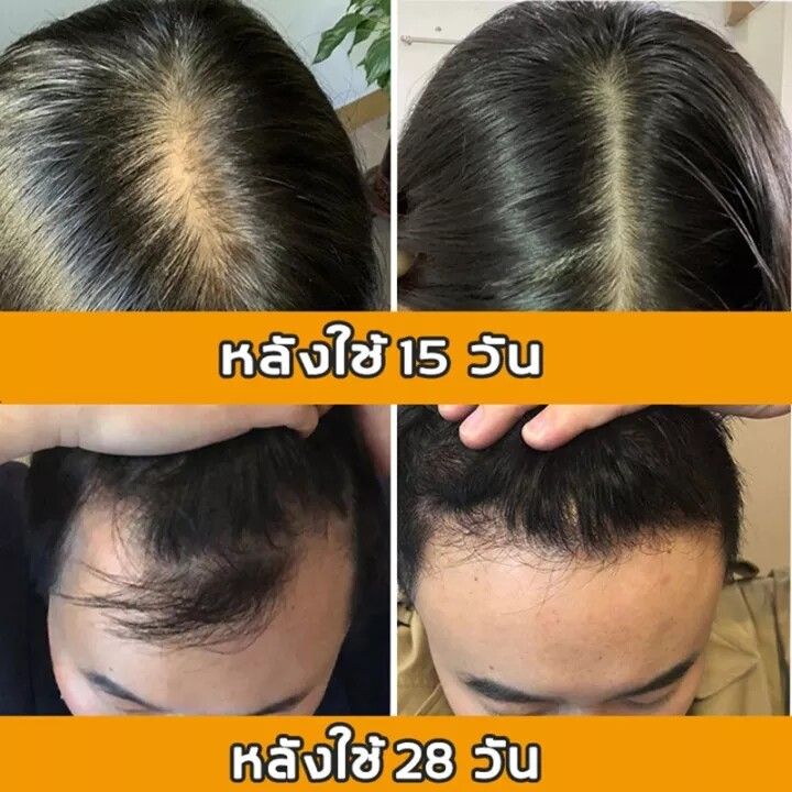 จัดส่งทันที-แชมพูสูตรขิง-ป้องกันผมร่วง-น้ำยาสระผมแก้ผมร่วง-แชมพูแก้ผมร่วง-แชมพูแก้ปัญหาผมร่วง-แชมพูสมุนไพร-แชมพูขิงเพียว-ทำให้รากผมแข็งแรงขึ้น-hair-loss-shampoo-เร่งผมเกิดใหม่-แชมพูสูตรขิงสด-250ml-แชม