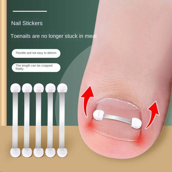 BAIXL Stainless Steel Toe Splint Support Relief Toe Braces Pedicure ...