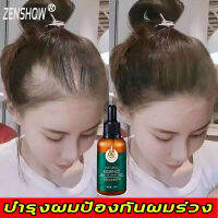 【ข้อเสนอเวลาจำกัด】ZESSHOW เซรั่มขิงบำรุงผม 30ml สูตรลับของขิง บำรุงรากผม ควบคุมความมัน ป้องกันผมร่วง （เซรั่มบำรุงผม ยาสระผมเร่งยาว น้ำยาเร่มผมยาว เซรั่มแก้ผมร่วง เซรั่มปลูกผม） hair loss serum