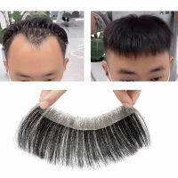 ผู้ชาย Toupee มนุษย์สั้น Hairpiece หน้าผากธรรมชาติ Hairline Patch สำหรับผู้ชาย V สไตล์ด้านหน้าชาย Remy ผมบางฐานผิว