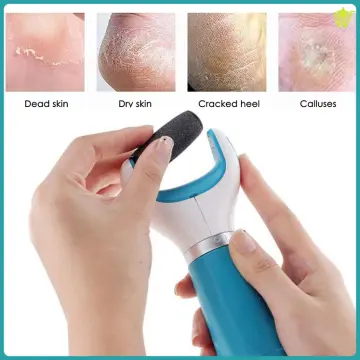 Rechargeable Electric Foot File Callus Remover Pedicure Machine Apparatus  for Heels Grinding Device Foot Corns Remove Roller - AliExpress